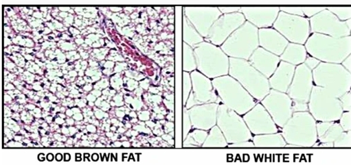 Good bad fat