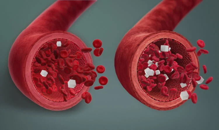 A medical illustration of blood vessels with red blood cells and sugar particles, highlighting the effects of supplements for blood sugar control.