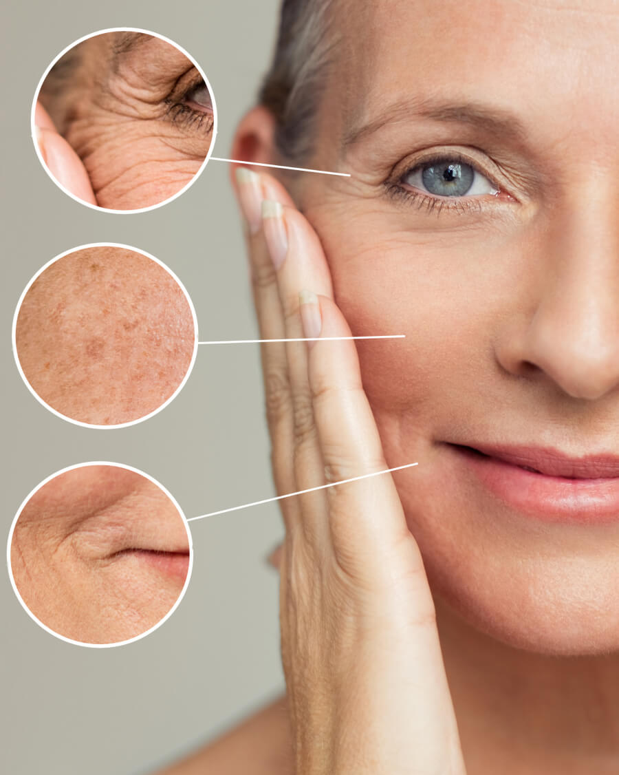 aging skin