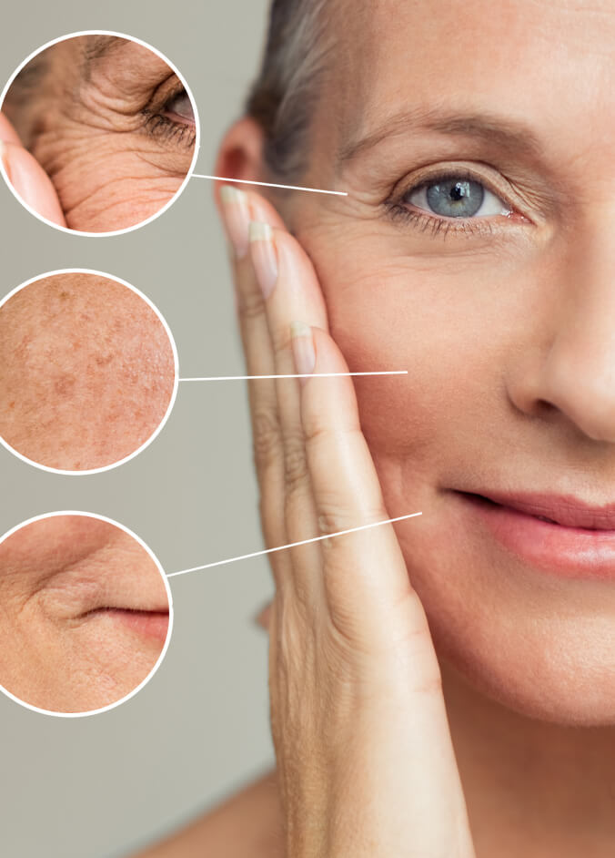 aging skin