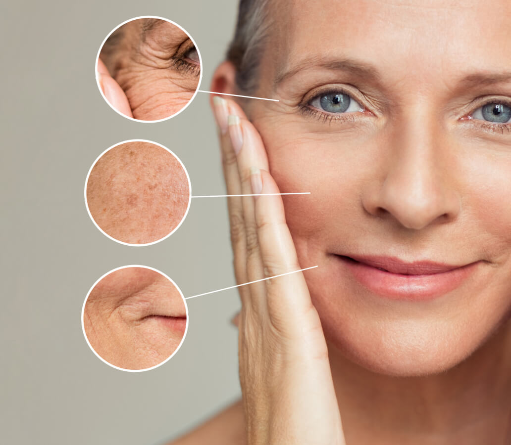 aging skin