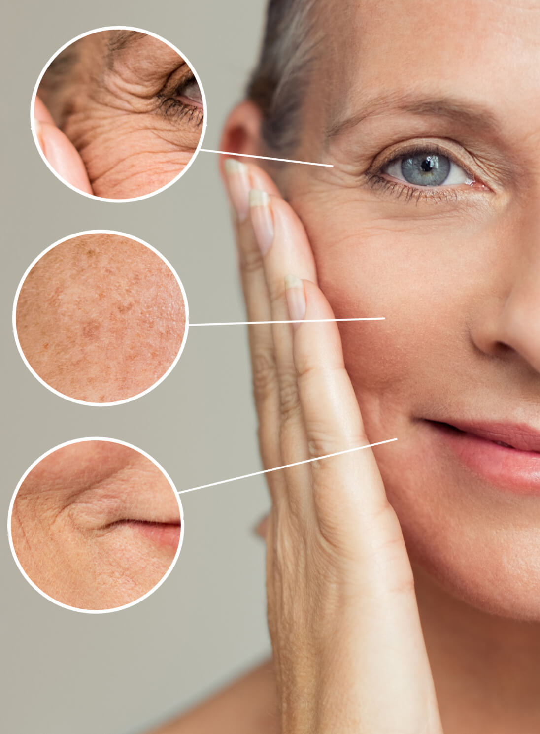 aging skin