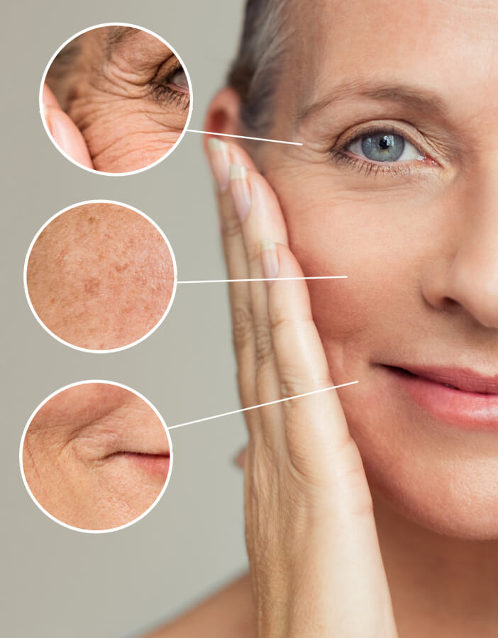 aging skin