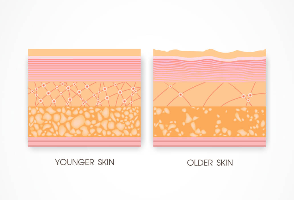younger older skin