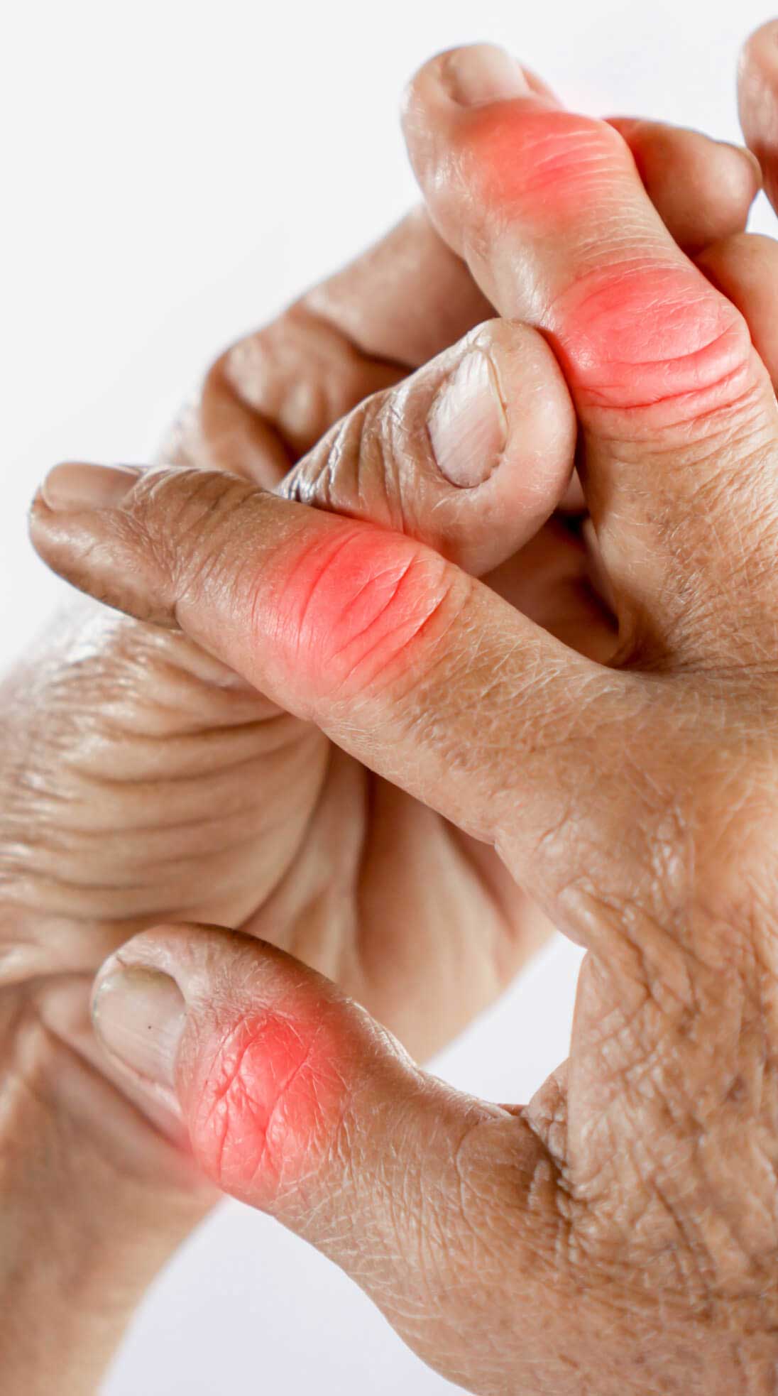 damaged hand nerve