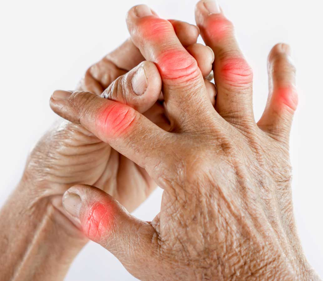 damaged hand nerves