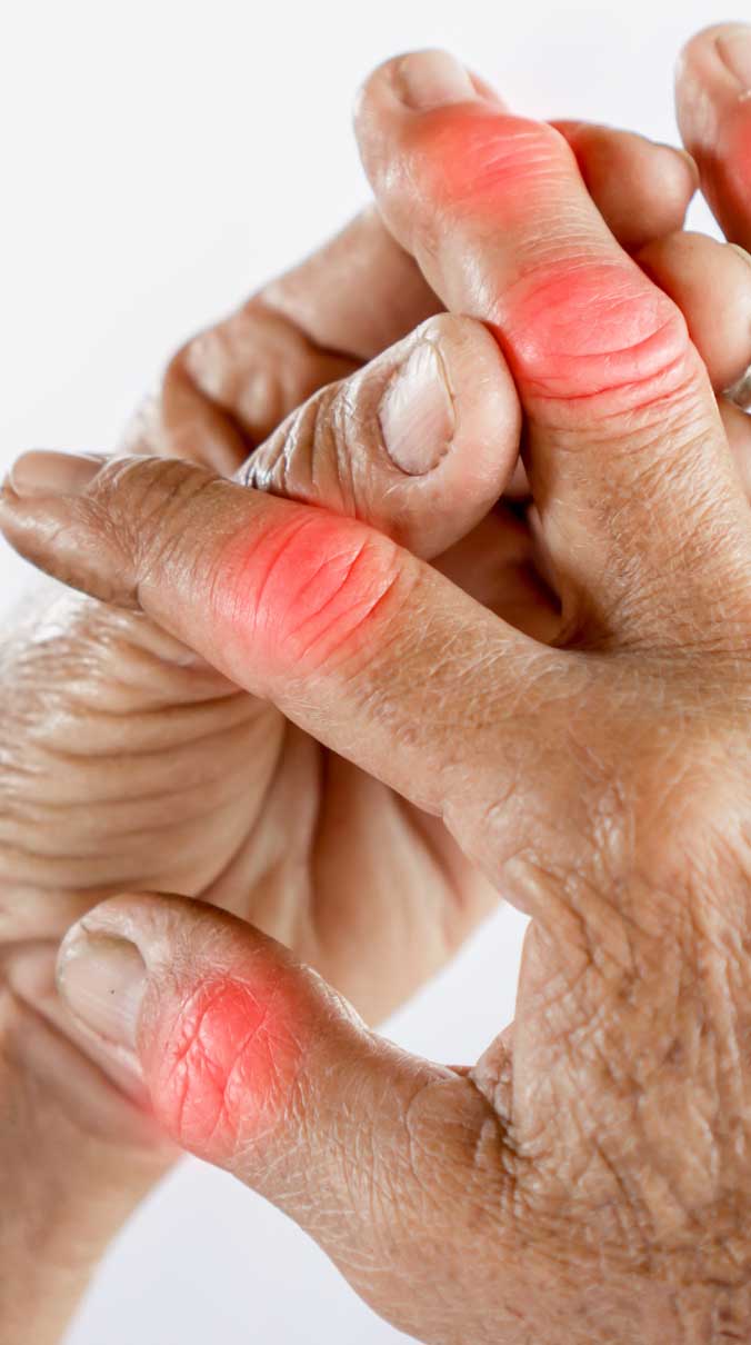 damaged hand nerve